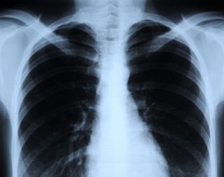xray how data science has helped the health sector